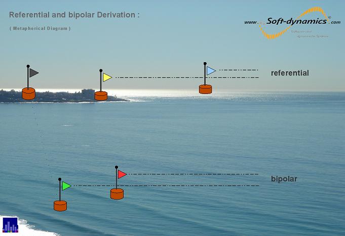 Neurofeedback - referential & bipolar montage