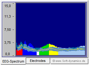 Neurofeedback - eBioo Amplitude