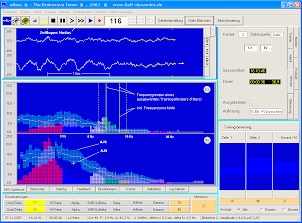 Neurofeedback - eBioo Hauptbildschirm