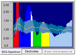 Neurofeedback - eBioo relative Amplitude